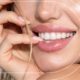 Teeth cleaning Sa 4 1 1520x435 gigapixel low res scale 2 00x