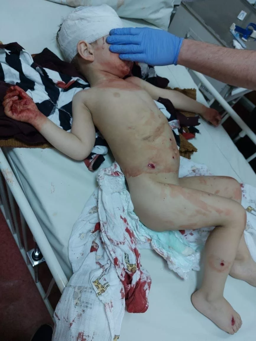 На Запоріжжі окупанти розстріляли з «Градів» колону біженців з Маріуполя – серед поранених дитина (відео)