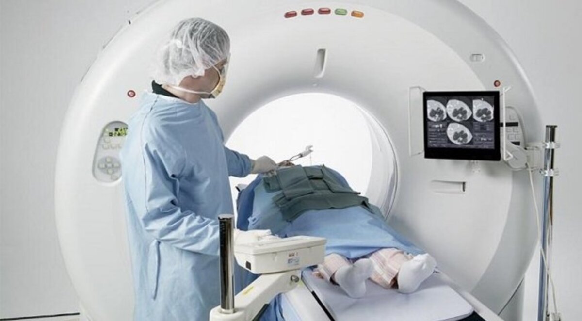 Українці можуть безплатно зробити рентген, МРТ та КТ: що для цього необхідно