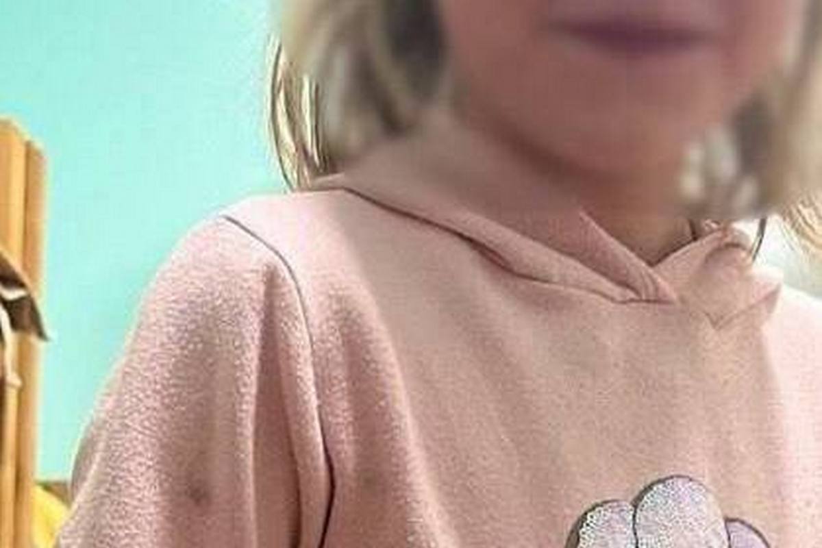 Нелюдська жорстокість - вихователька на Київщині катувала 9-річну дитину