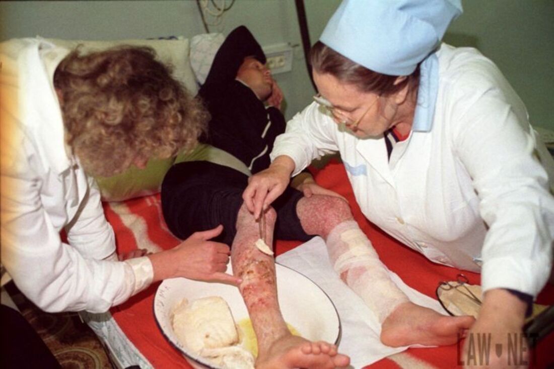 Шокуючі фото з Чорнобиля: перші дні після аварії і жертви радіації