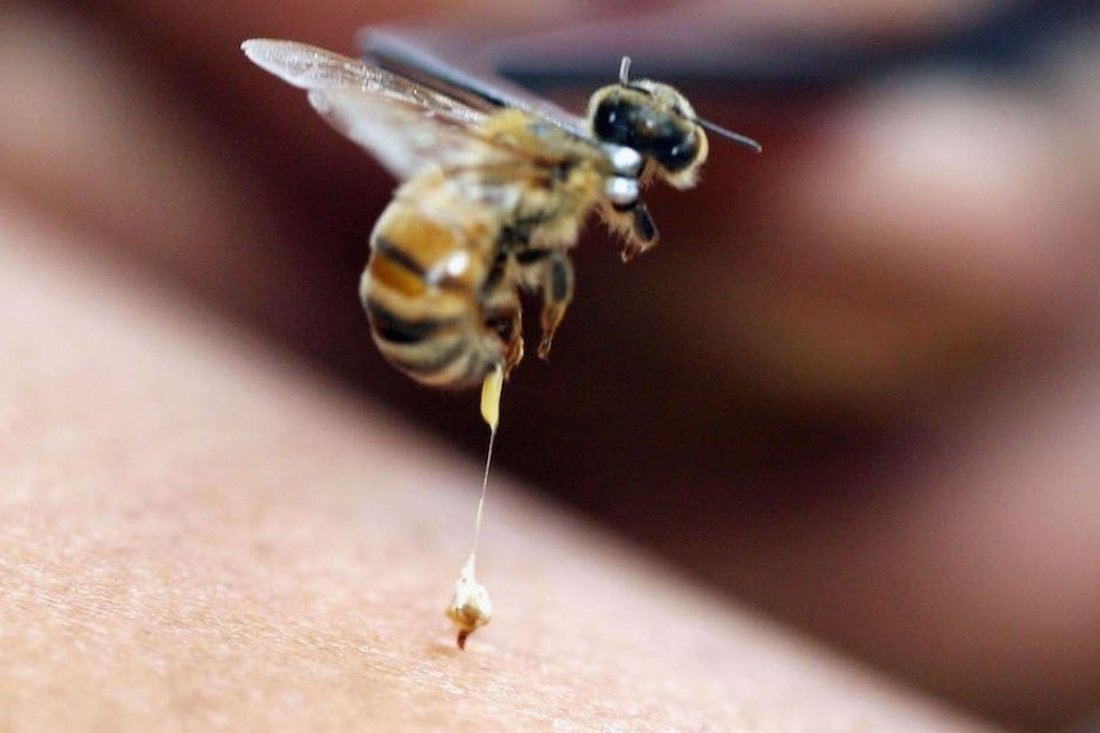 Укус бджоли – що буде, якщо не витягнути жало