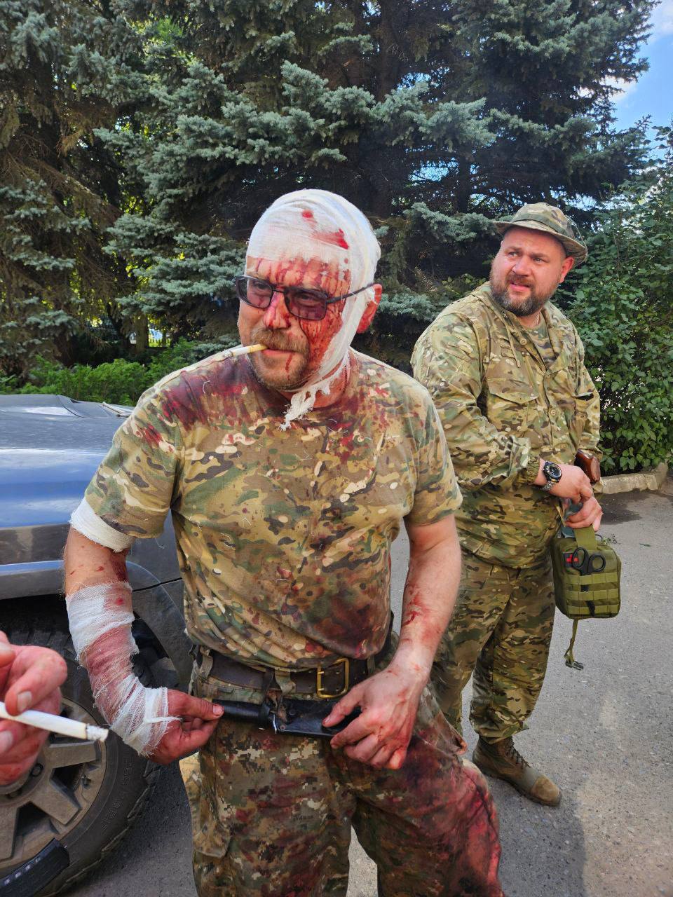 Треш-вісті з боліт 22 липня: впав міст, кип’яток вбив людей, божевільний захопив будинок Януковича (фото, відео)