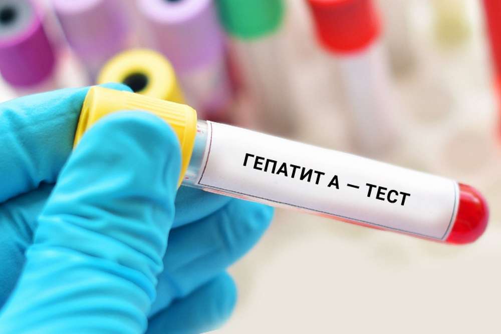 На Вінниччині спалах вірусного гепатиту А – госпіталізовано 60 людей