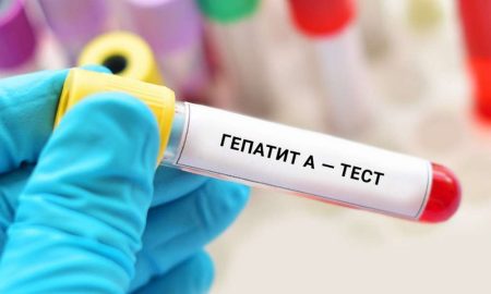На Київщині виявили Гепатит А у коледжі – 84 контактні особи на карантині