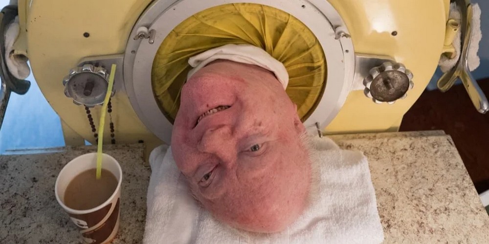 Понад 70 років прожив в апараті «залізні легені»: у США помер Пол Александер