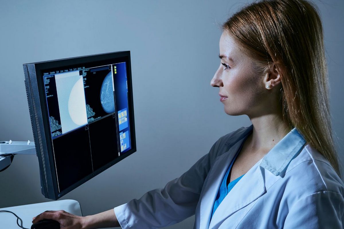 Чи потрібно платити за результати мамографії на плівці або цифровому носії – пояснення НСЗУ