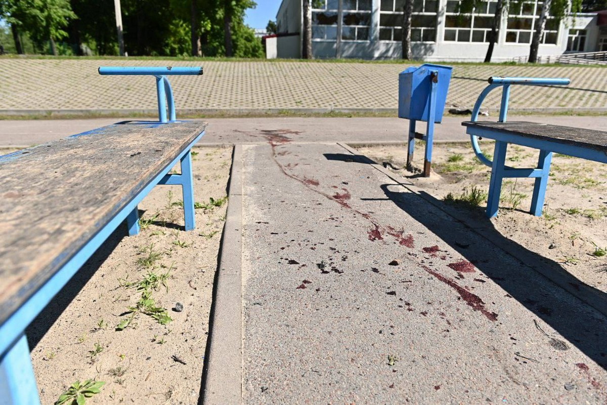 Вдарили по шкільному стадіону посеред дня: серед поранених 4 дітей у Харкові