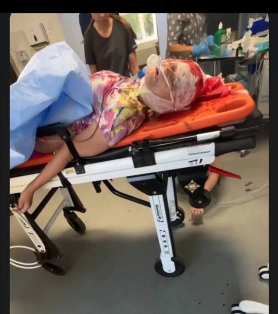 В мережі опублікували фото Ірини Фаріон з лікарні. Офіс Генпрокурора повідомляє, що її з проникаючим вогнепальним пораненням голови у вкрай важкому стані було доставлено до лікарні.