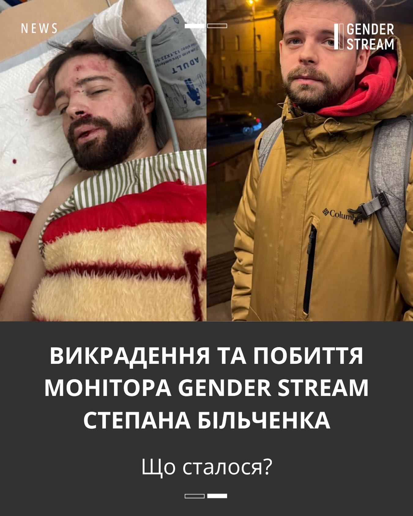 Викладача зі Львова знайшли з проломленим черепом на трасі під Житомиром – що відомо